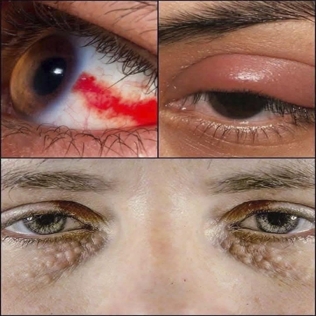 Condiciones oculares