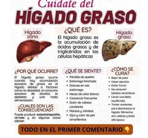 Todo lo que necesitas saber sobre el hígado graso: síntomas, causas y tratamientos