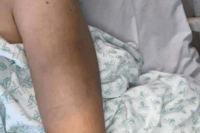 Mejora tu Sueño y Salud: Remedios Naturales para un Descanso Efectivo