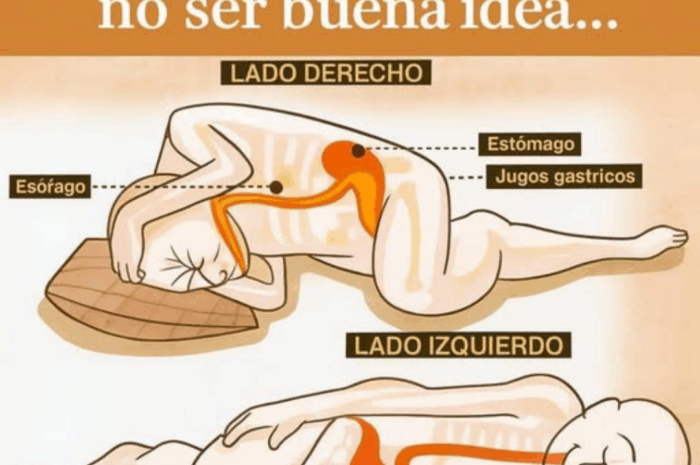 La Importancia de la Posición al Dormir: Salud y Reflujo Gástrico