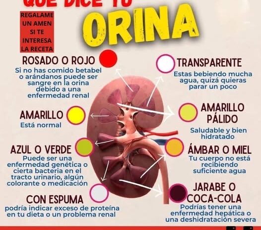 ¿Qué Color Tiene Tu Orina? Descifra Las Señales de Salud A Través de Su Color