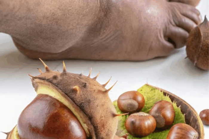 El Poderoso Remedio Natural para las Piernas Hinchadas a Base de Castañas