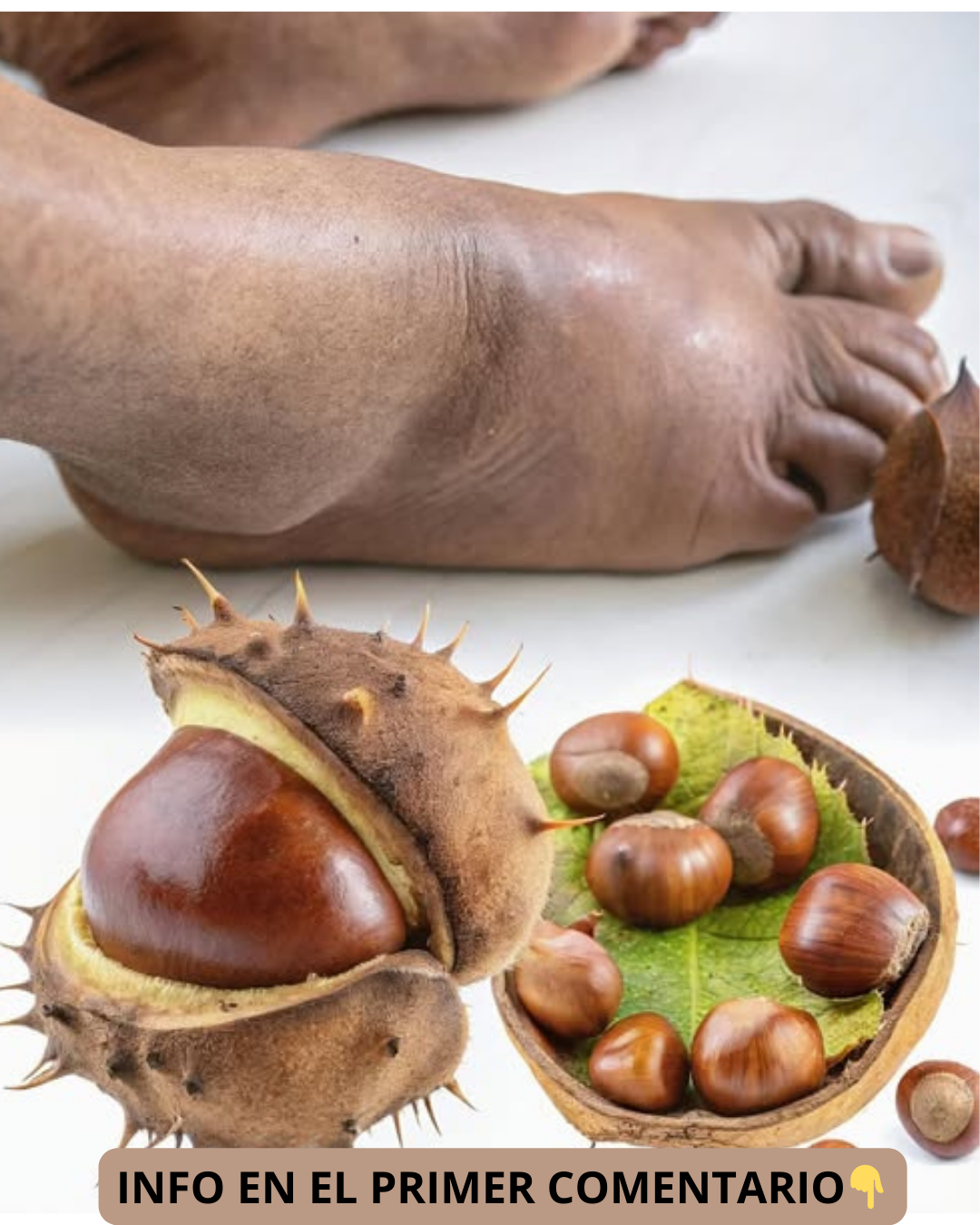 Castañas para el tratamiento de piernas hinchadas