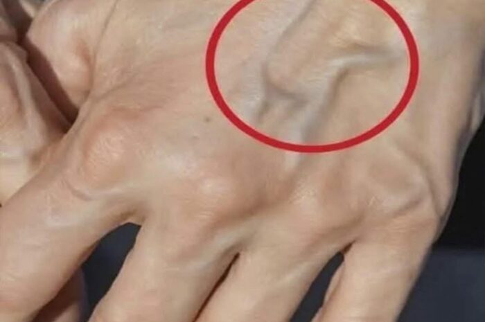 ¿Por qué tienes venas visibles? Remedios Naturales para Mejorar la Circulación