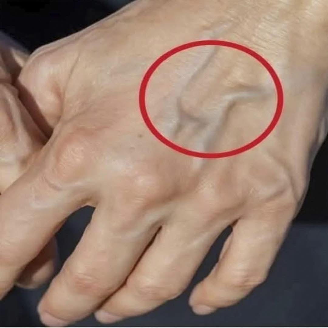 Mano con venas visibles