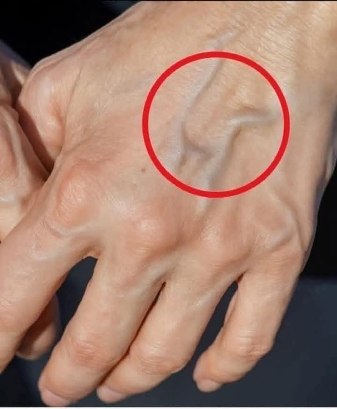 Venas visibles en la mano