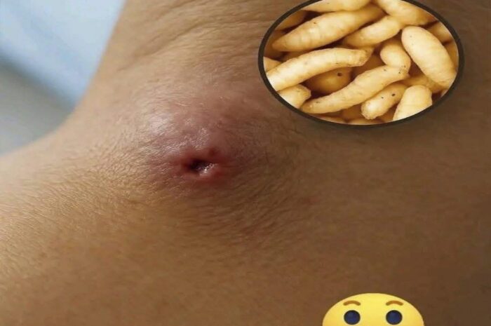 Piel y Salud: Identificando Consecuencias de Infecciones Cutáneas
