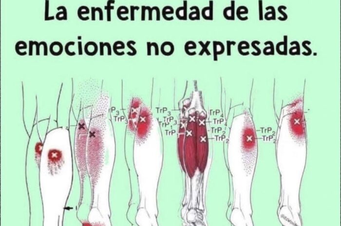 Fibromialgia: La Enfermedad Silenciosa y Sus Remedios Naturales