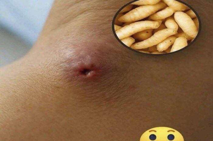 De la Confusión al Conocimiento: Afecciones Cutáneas y Remedios Naturales