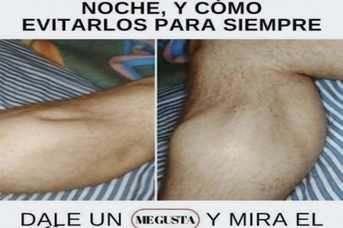 Calambres Nocturnos en las Piernas: Causas y Cómo Prevenirlos para Siempre