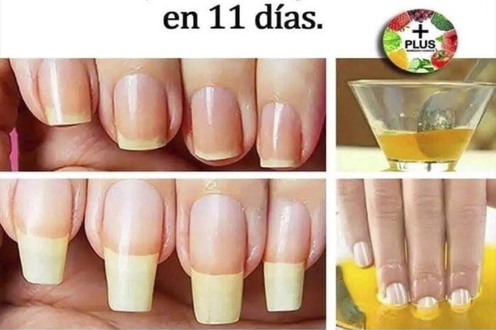 Remedios Caseros para Uñas Fuertes: Estrategias para Hacerlas Crecer Saludables