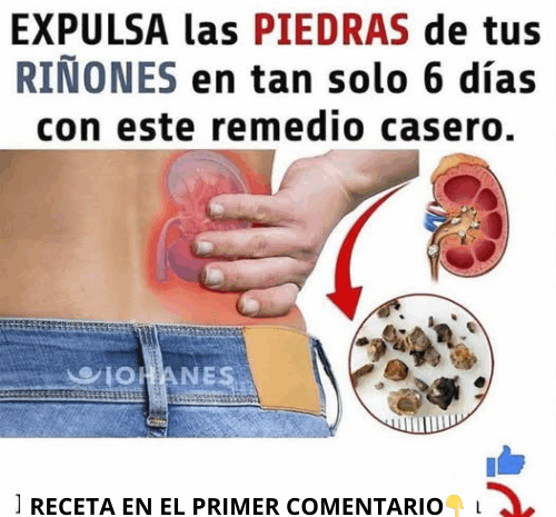 Expulsa las Piedras de tus Riñones de Forma Natural y Efectiva