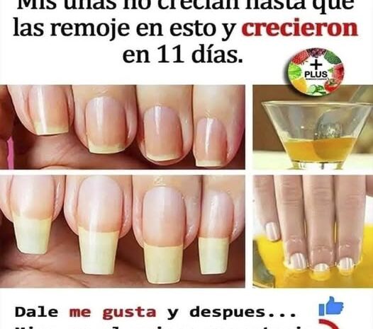 Cómo Fortalecer Tus Uñas: Receta Casera para el Crecimiento Saludable