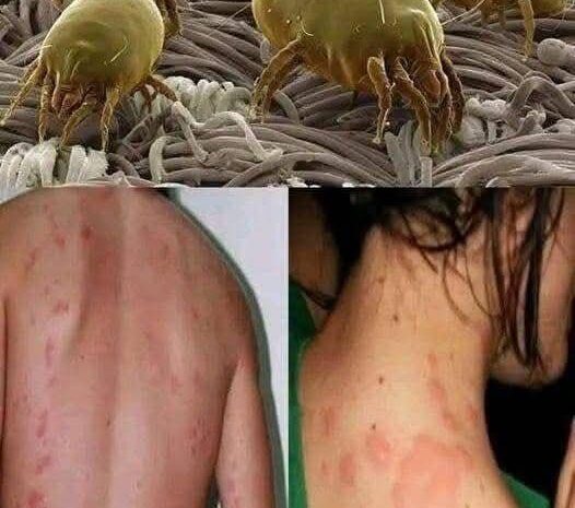 Cómo Combatir los Ácaros del Polvo en Tu Hogar: Remedios Naturales y Salud