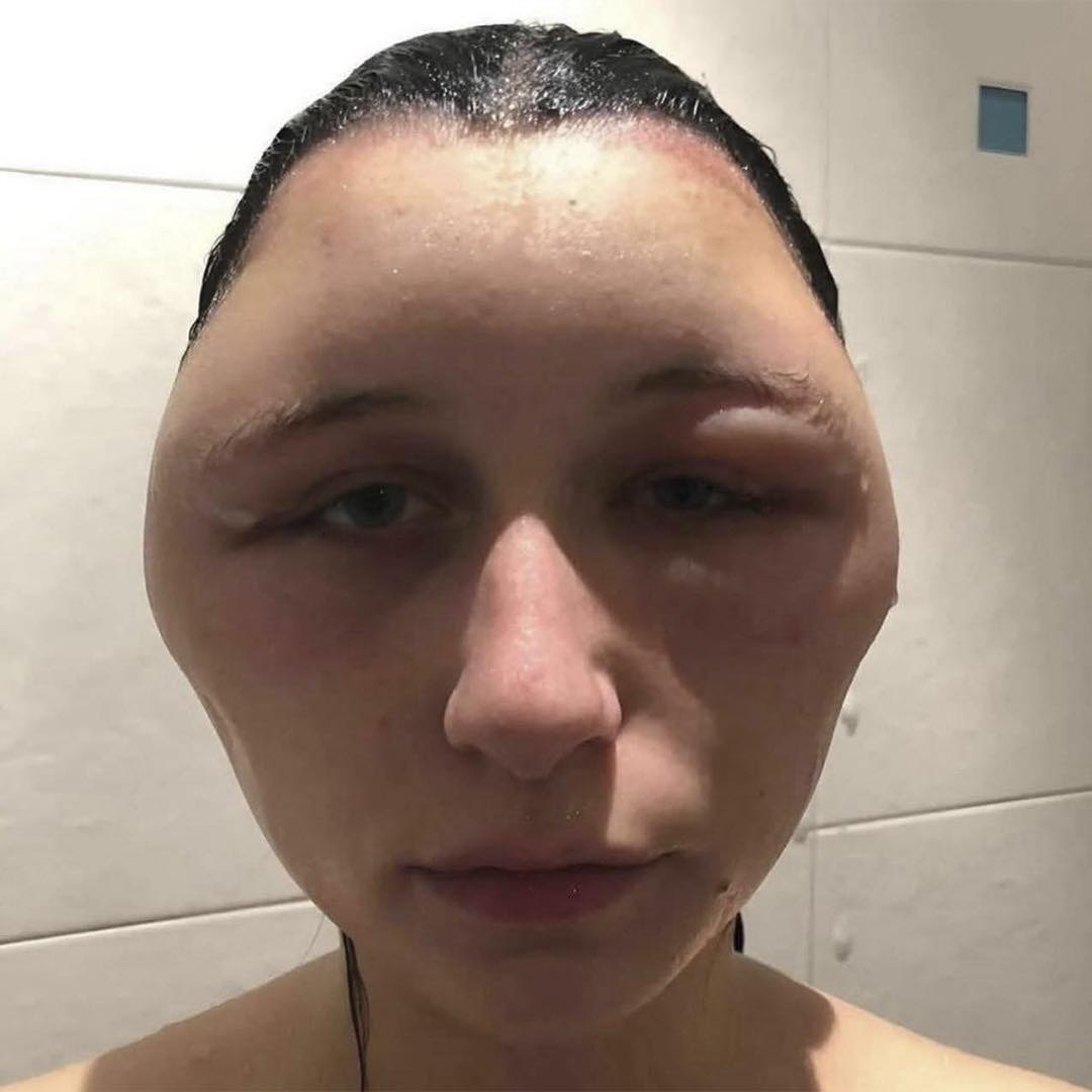 Cuidados del cabello