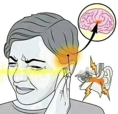 El Zumbido en Tus Oídos: Señales de Alerta que No Ignorar