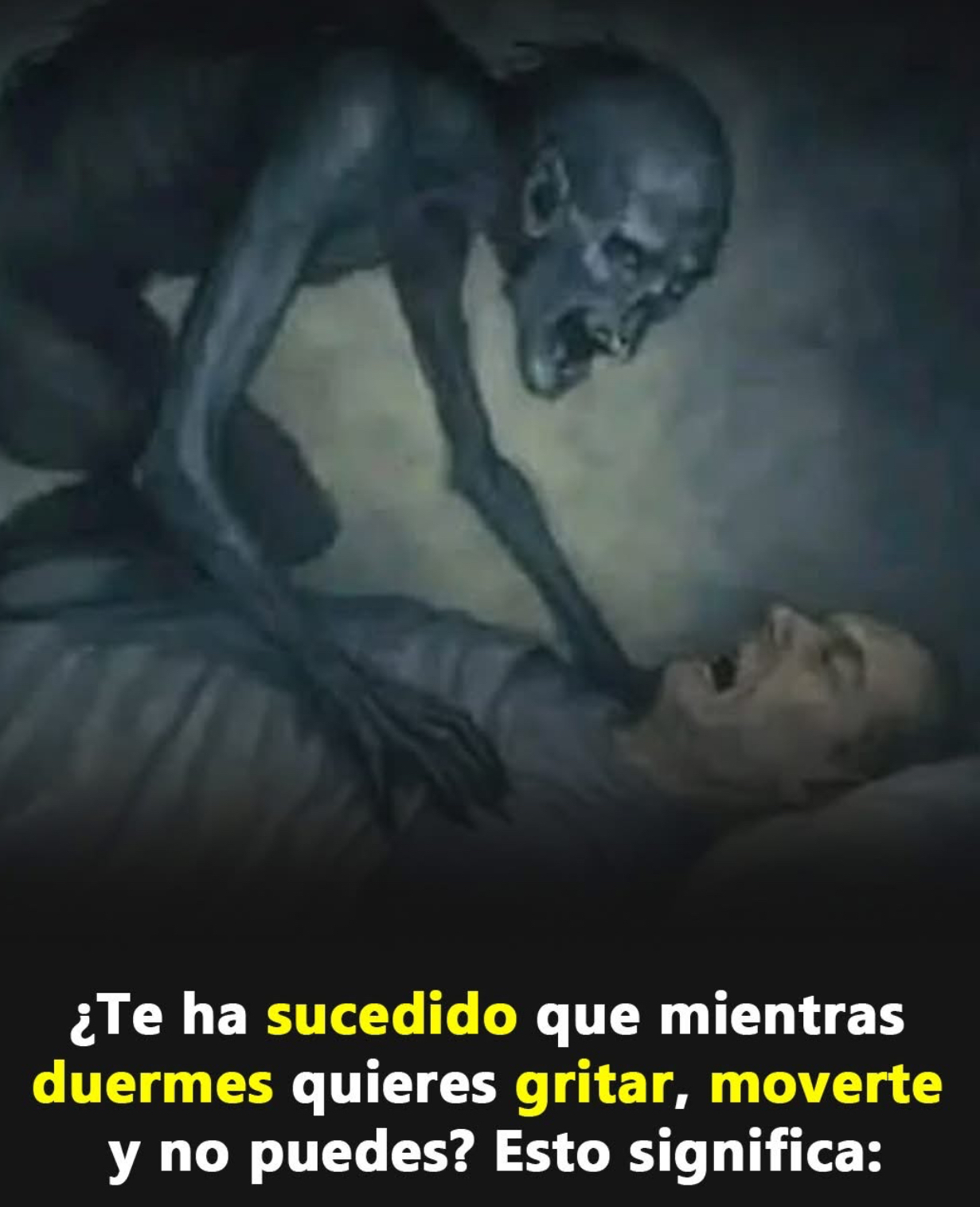 Ilustración de parálisis del sueño