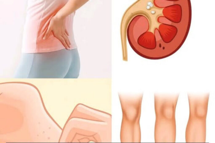 ¡Cuidado con tus Riñones! 8 Señales de Advertencia de Problemas Renales