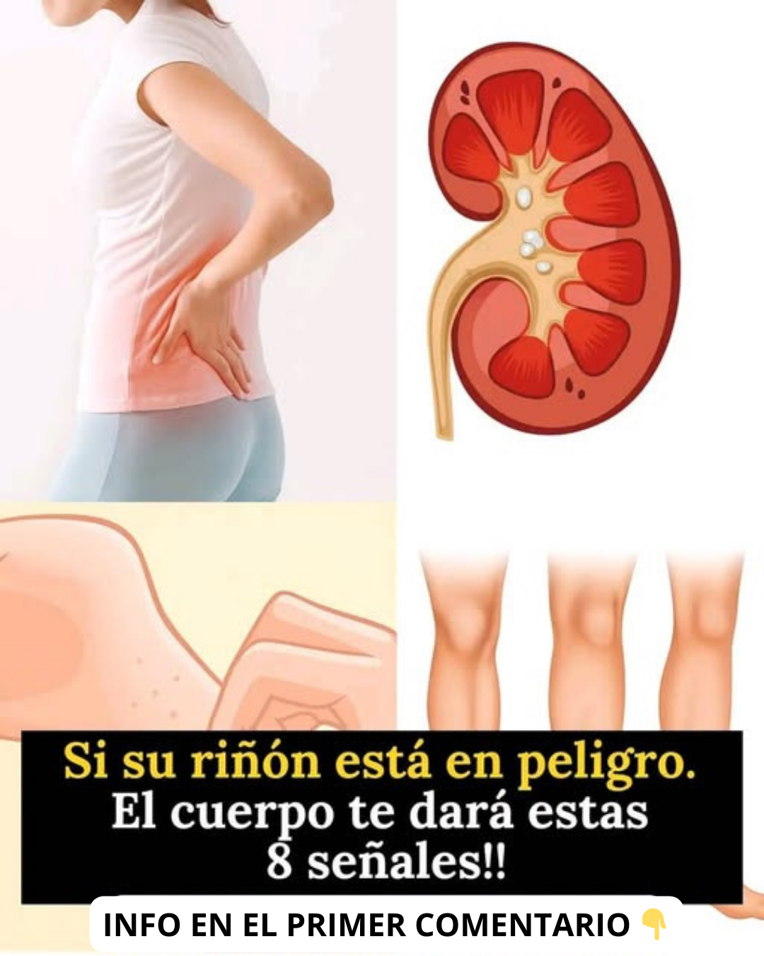 Señales de advertencia de problemas renales