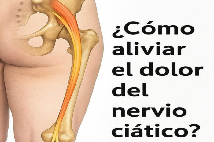 Cómo Aliviar el Dolor del Nervio Ciático: Remedios Naturales y Caseros