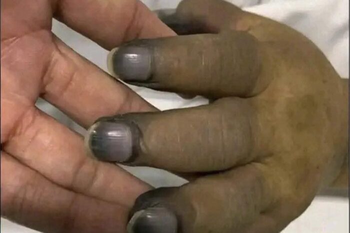 Por qué no debes pintarte las uñas con esmaltes dañinos: Claves para una salud óptima