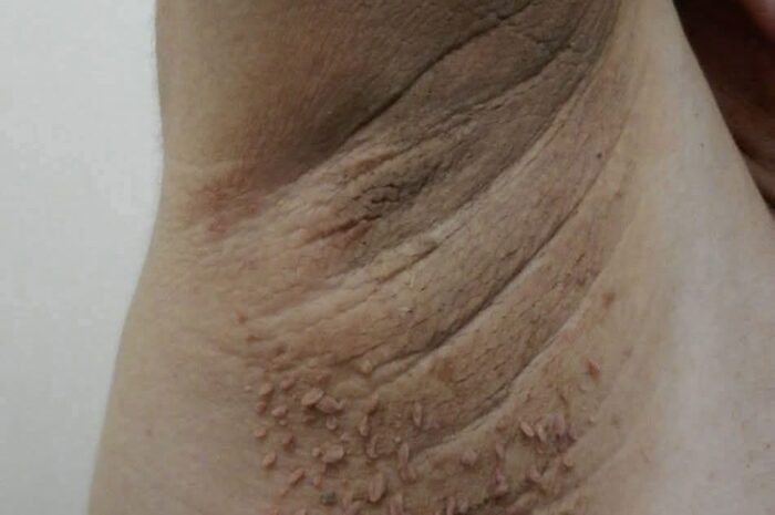 Los Primeros Síntomas de que Tu Cuerpo Necesita un Cambio