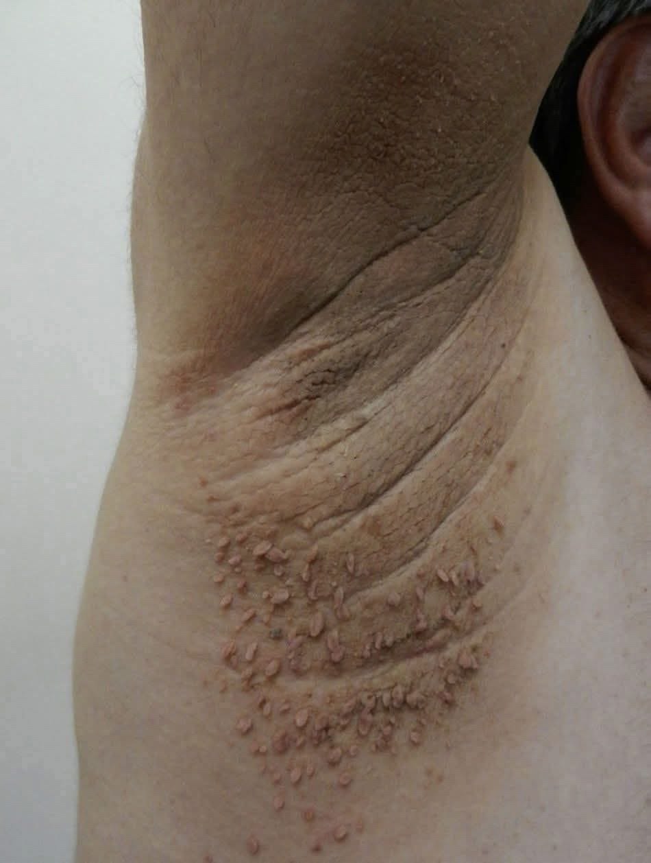 Síntomas de que el cuerpo necesita un cambio
