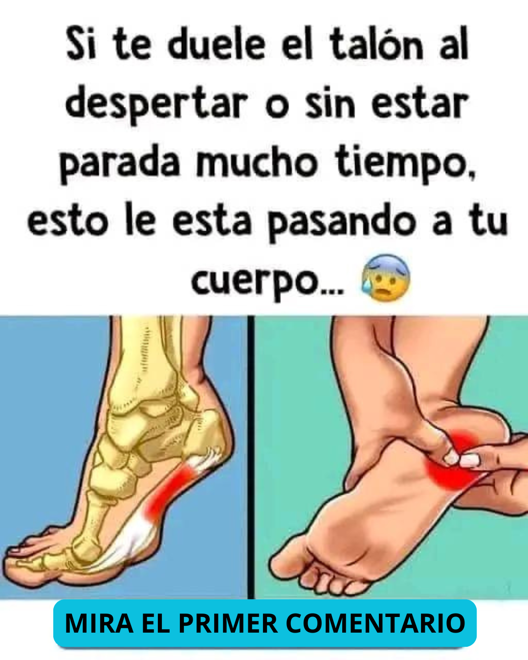 Anatomía del pie con dolor en el talón