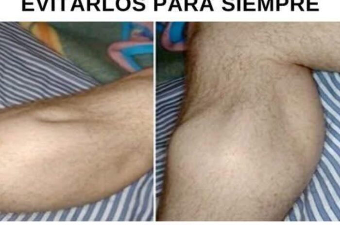 Calambres Nocturnos: Razones y Remedios Naturales para Evitarlos