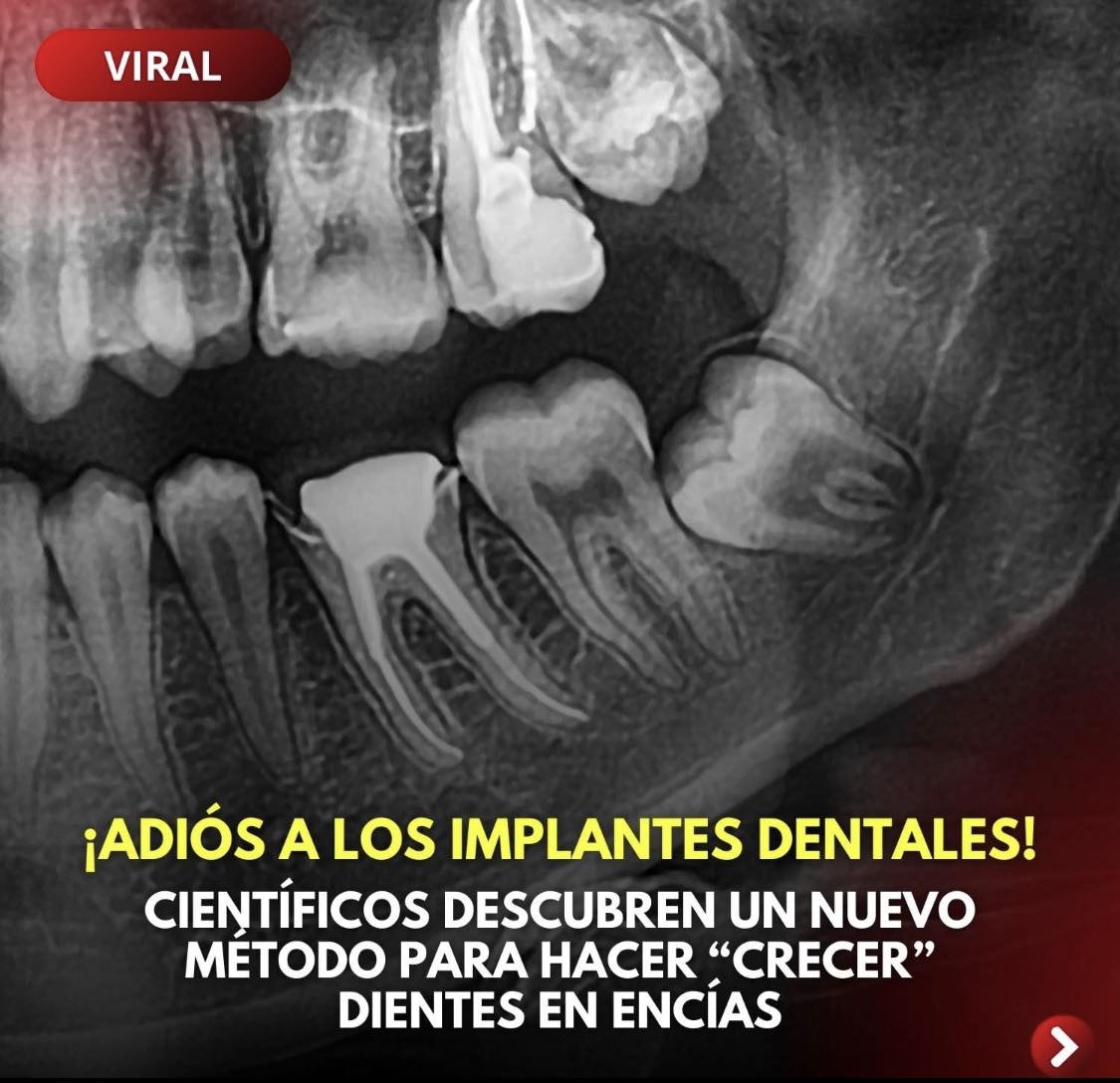 Radiografía dental con nuevo método de regeneración de dientes