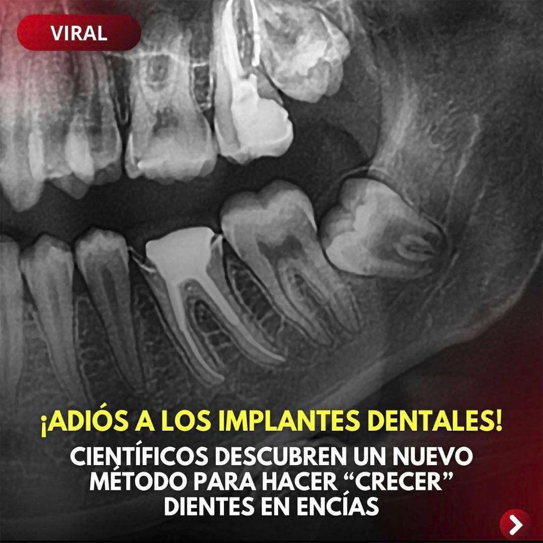 Radiografía Dental