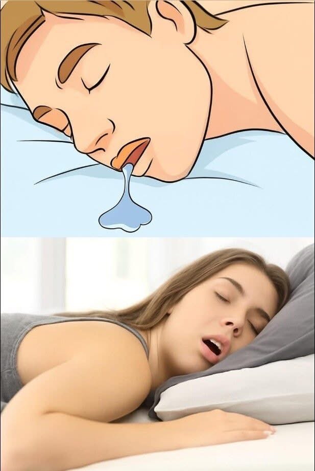 Personas durmiendo con la boca abierta