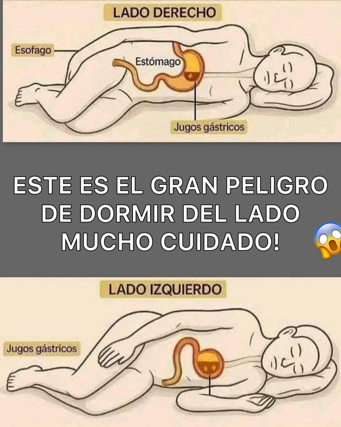 Diagrama comparativo de dormir del lado derecho e izquierdo