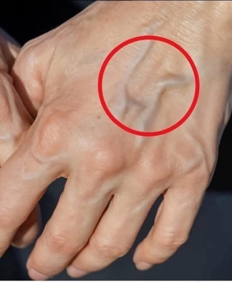 Venas visibles en la mano
