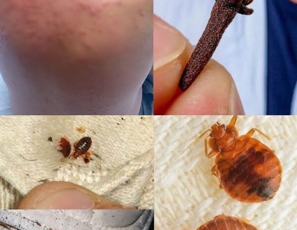 Chinches en Casa: Síntomas, Prevención y Remedios Naturales