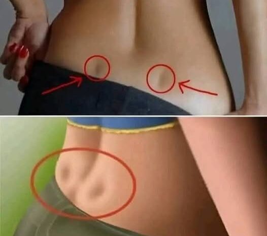 Los Hoyuelos de Venus: Estética y Salud en la Anatomía Humana