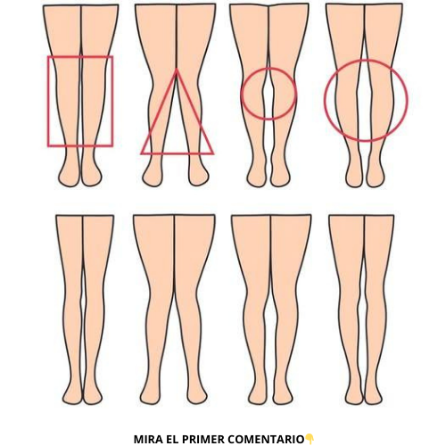 Diversos tipos de piernas en figuras geométricas