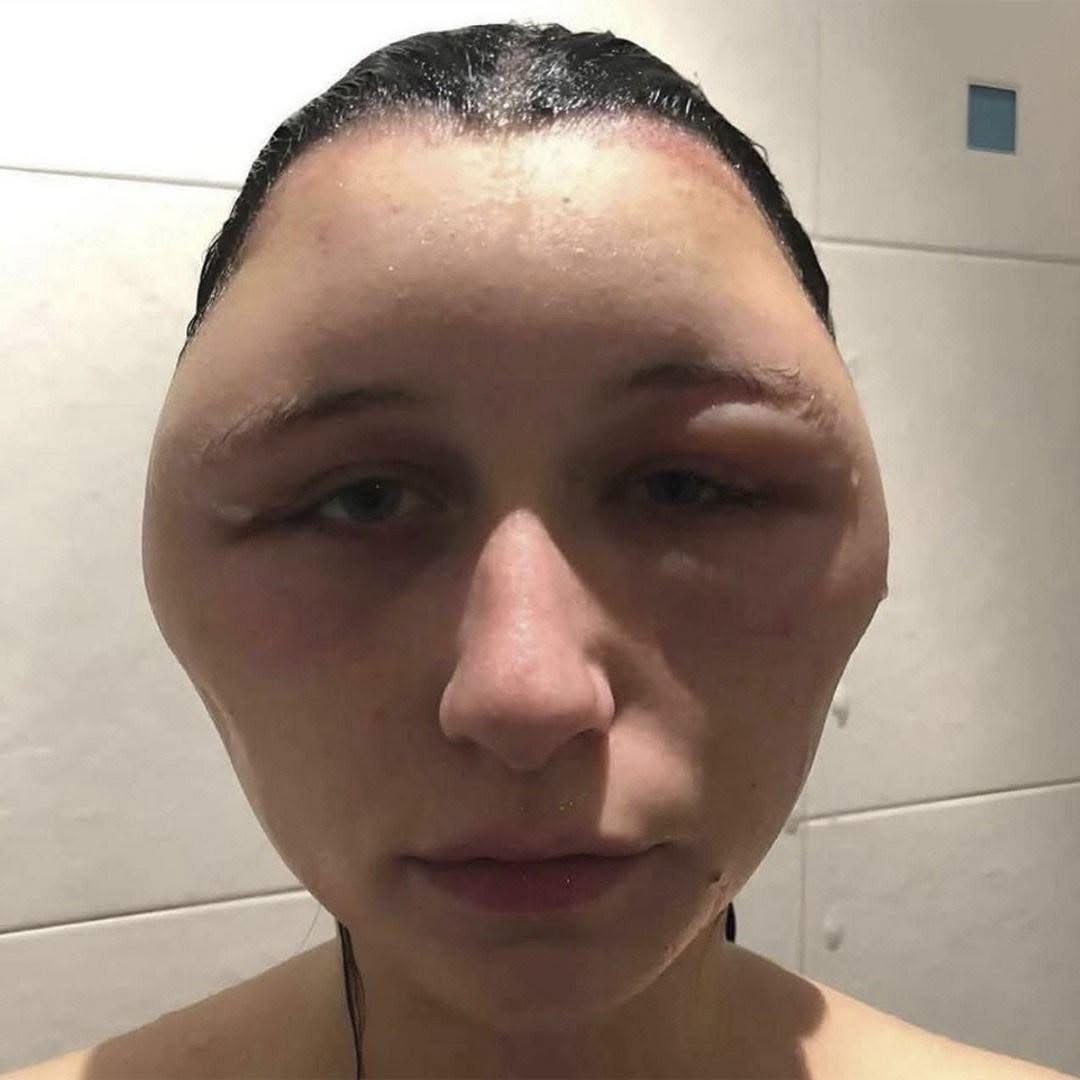 Cuidado del cabello