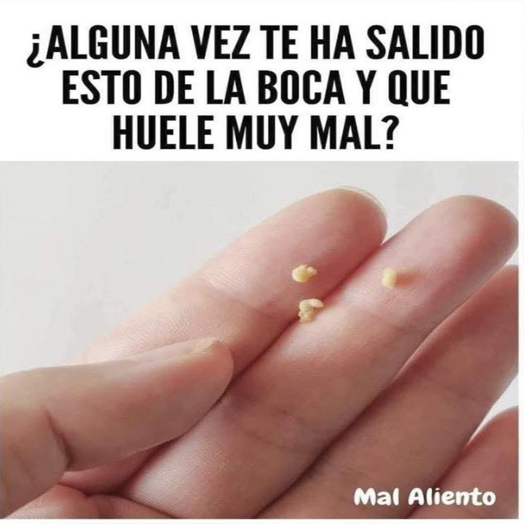 Cáseos amigdalinos