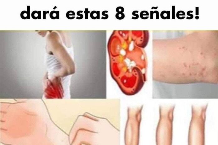 8 Señales de que tus Riñones Están en Peligro