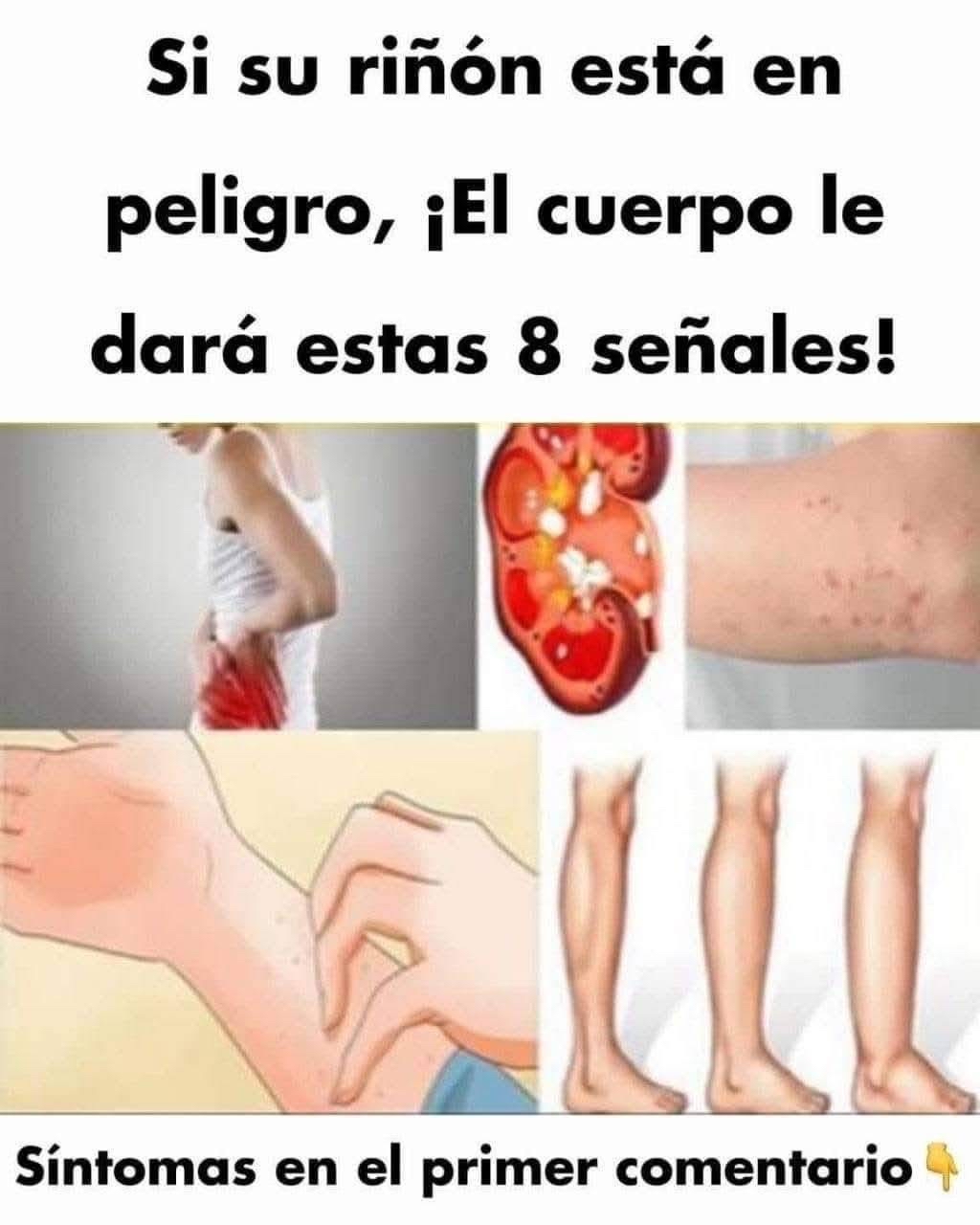 Señales de riñones en peligro