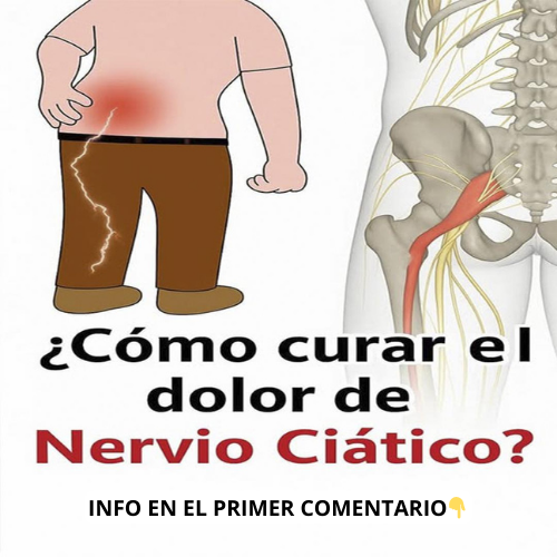 Dolor del Nervio Ciático