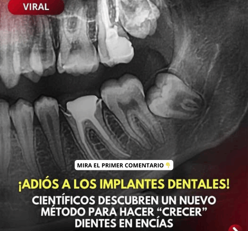 ¡Adiós a los Implantes Dentales! Nuevos Avances en el Crecimiento de Dientes Naturales