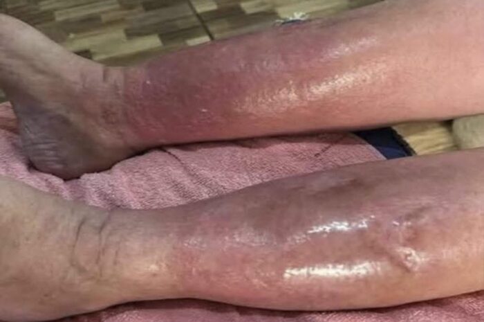 Señales de Problemas de Piel y Remedios Naturales para Mejorar tu Salud