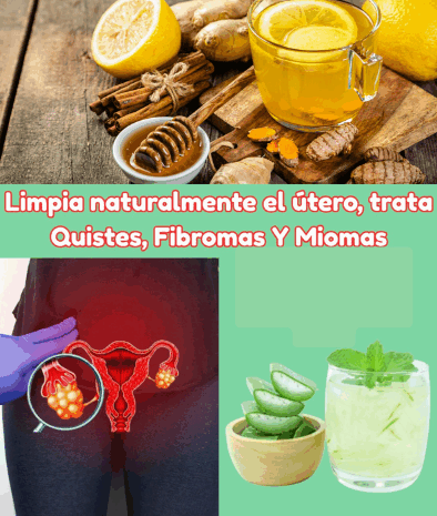 Limpieza Natural del Útero: Remedios para Tratar Quistes, Fibromas y Miomas