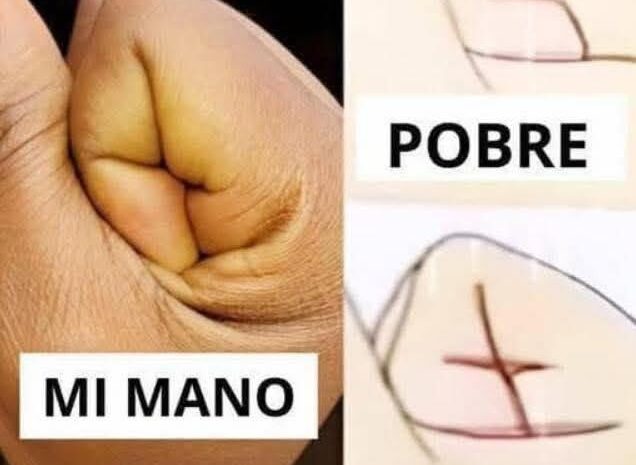 Nuestras Manos: ¿Reflejo de Riqueza o Pobreza?
