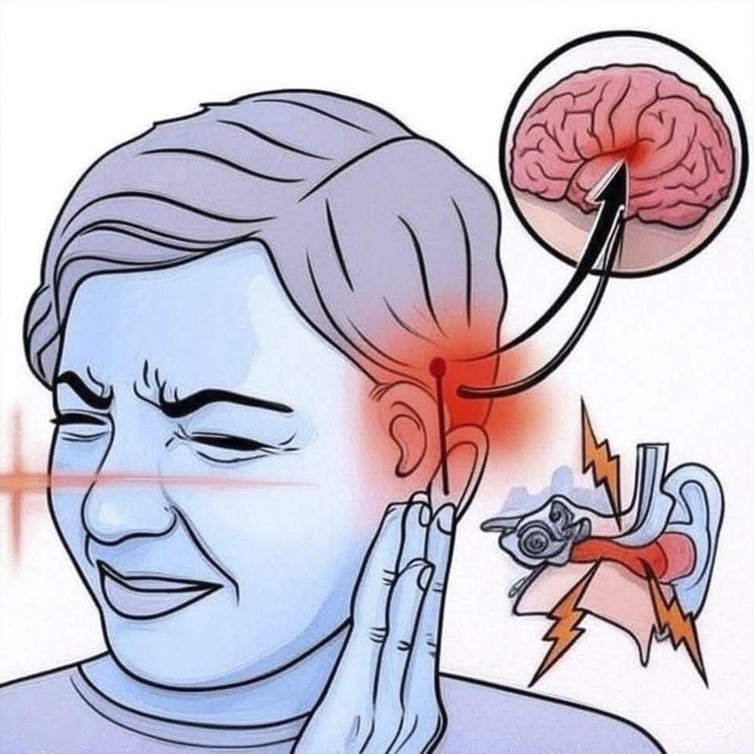Dolor de oído y su relación con el cerebro