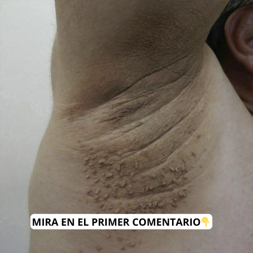 Síntomas de Enfermedades Comunes