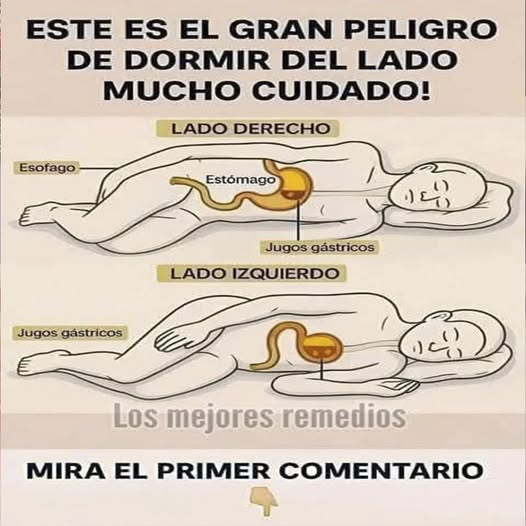 Impacto de dormir del lado derecho e izquierdo