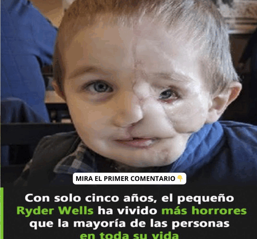 El Poder de los Remedios Caseros: Salud y Bienestar en tu Hogar